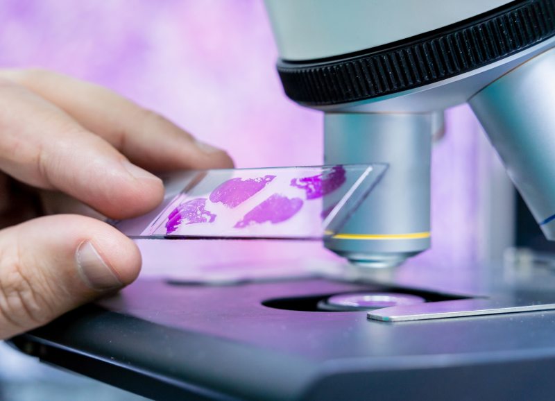 Kategorie cytologiczne – analiza i zrozumienie wyników badań